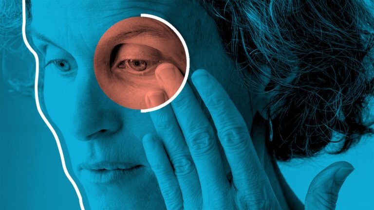 woman touching eye, blue tint with circle around eye